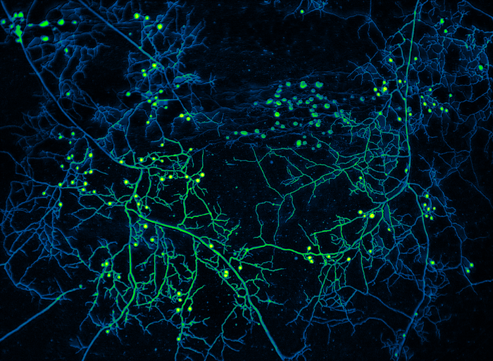 False colour image of fungi in shades of blue and green on a black background